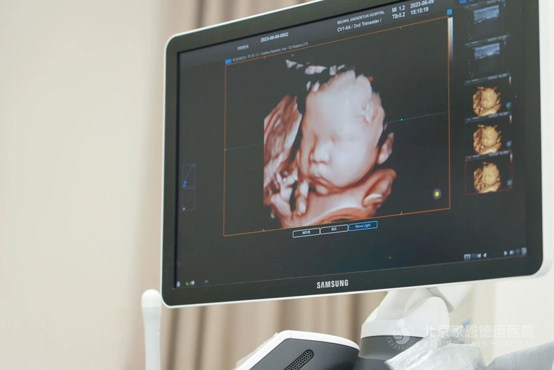 17365484825055333微(wēi)信圖片_20250110223738.jpg 微(wēi)信圖片_20250110223738.jpg